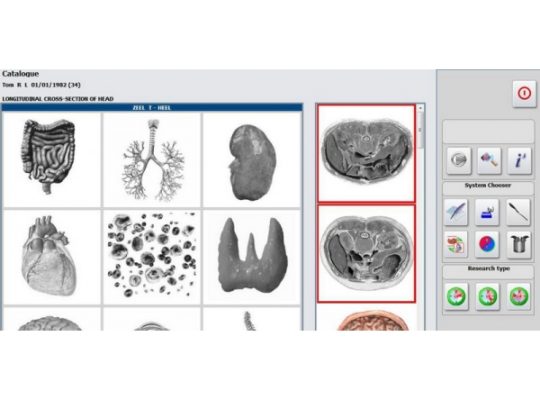 METATRON HUNTER – NLS – Aparat de diagnoza si tratament prin biorezonanta magnetica (cod E42-1)