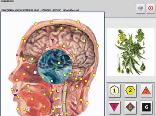 METATRON HUNTER – NLS – Aparat de diagnoza si tratament prin biorezonanta magnetica (cod E42-1)