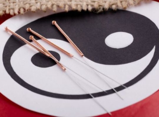 Ace acupunctura