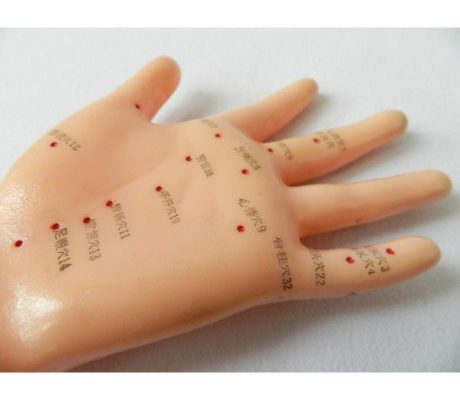 Model mana studiu acupunctura (cod S01)