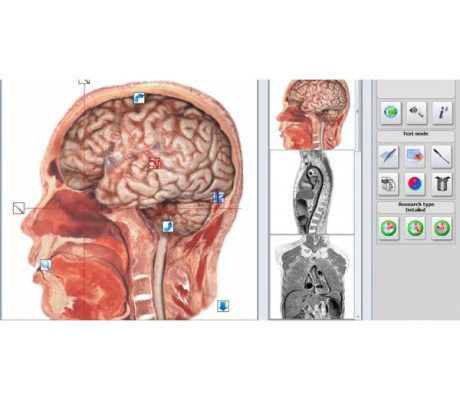 METATRON HUNTER – NLS – Aparat de diagnoza si tratament prin biorezonanta magnetica (cod E42-1)